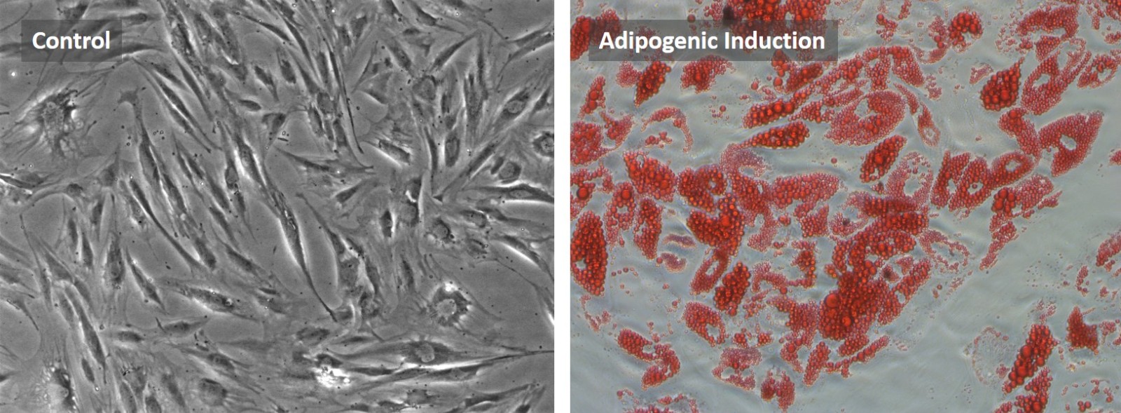 Human ADSC adipocyte differentiation.jpg