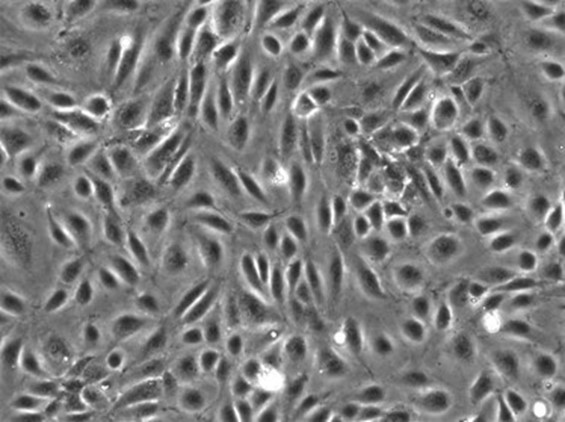 Human_hepatic_sinusoidal_endothelial_cells.jpg
