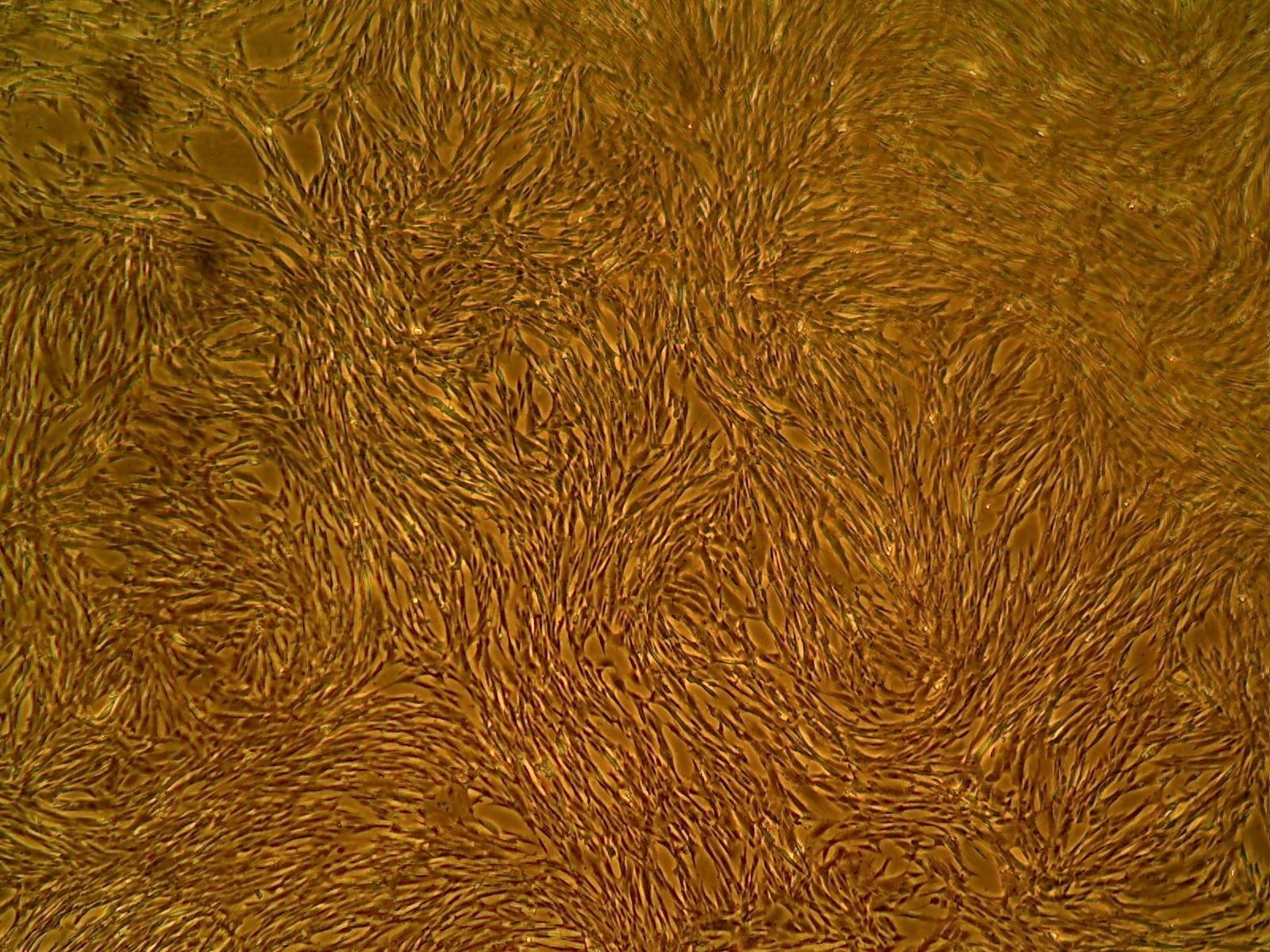 人滑膜基质细胞（HSSC）