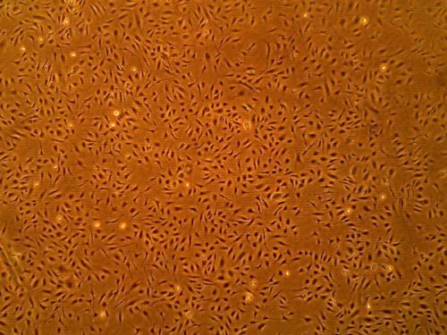 人视网膜微内皮细胞(HRMEC）