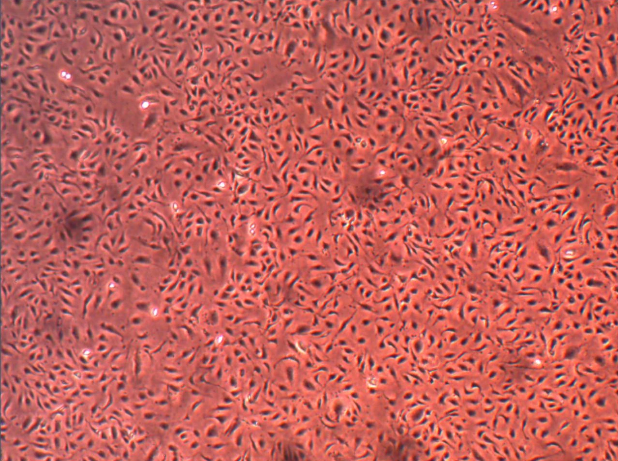人肝窦微血管内皮细胞（HLSMEC）