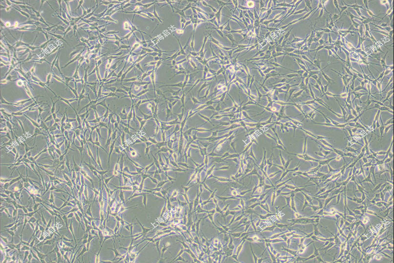 RG2 [D74]大鼠胶质瘤细胞