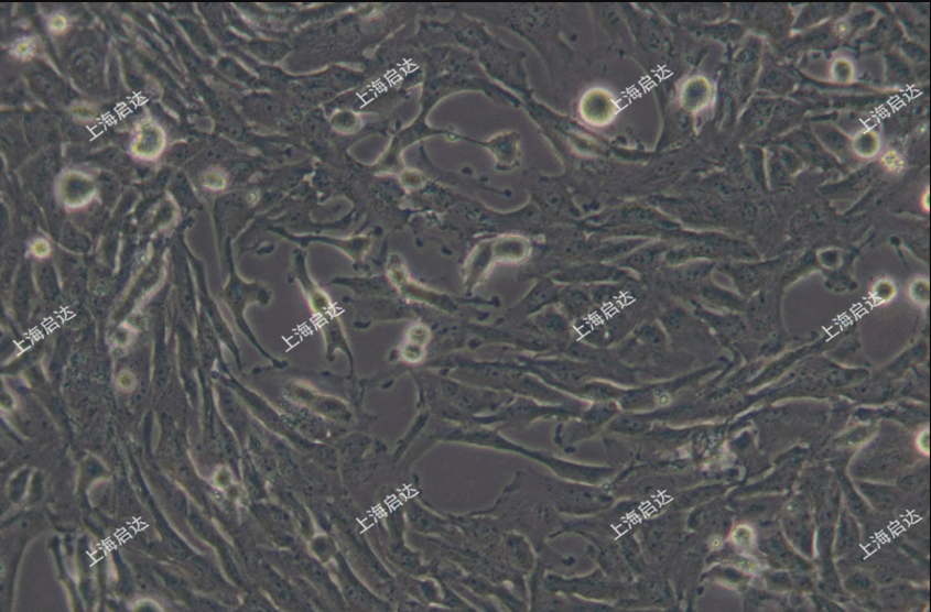 U251人神经胶质细胞瘤细胞