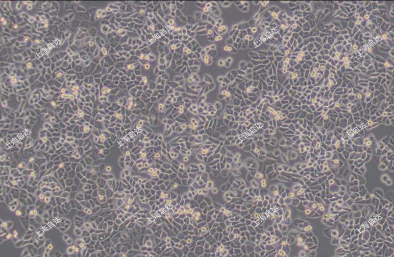 MDA-MB-468人乳腺癌细胞