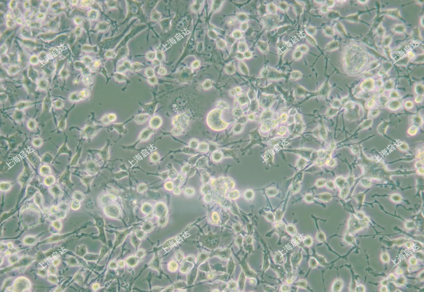 MDA-MB-436人乳腺腺癌细胞