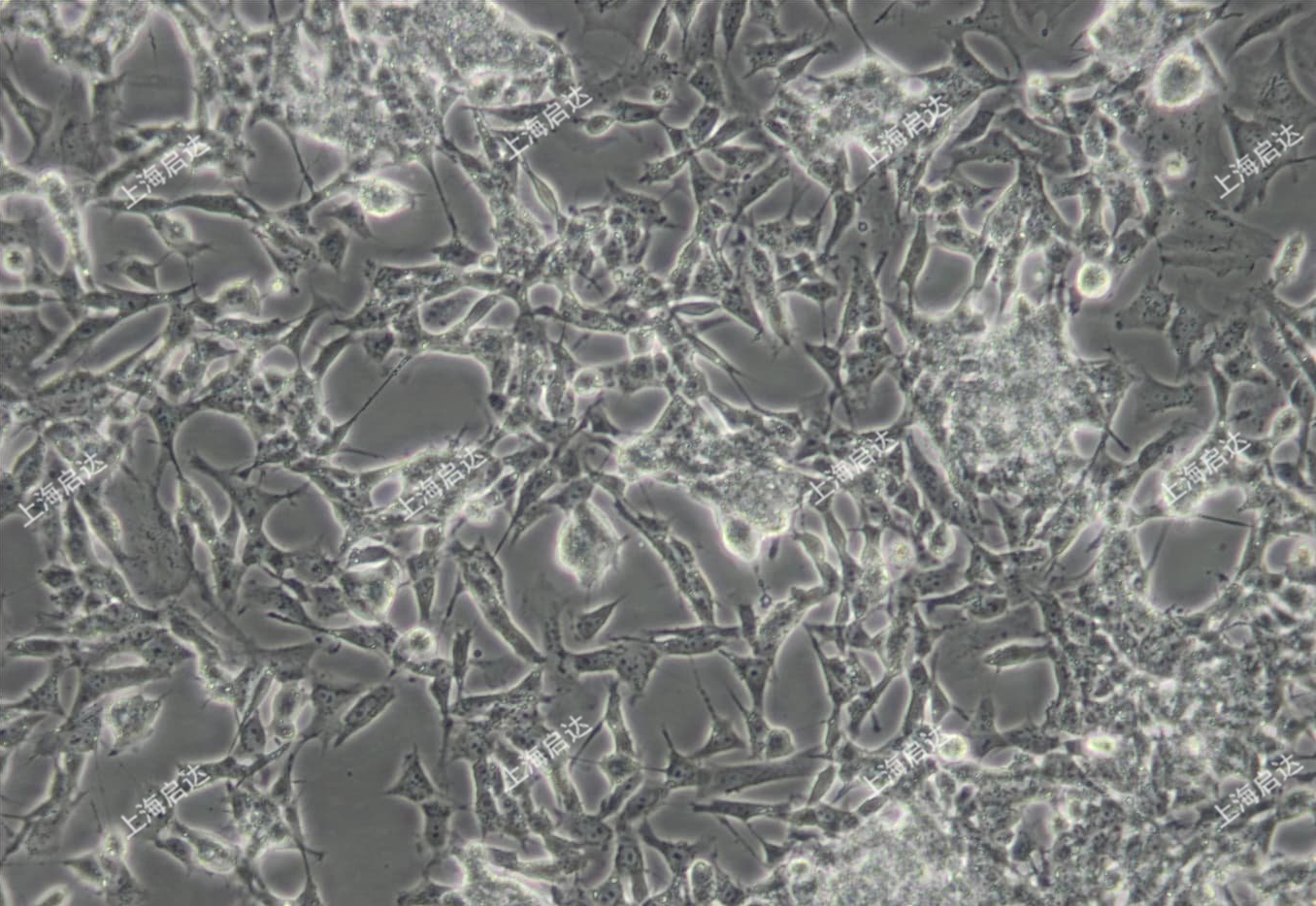 SK-N-BE(2)人神经母细胞瘤细胞