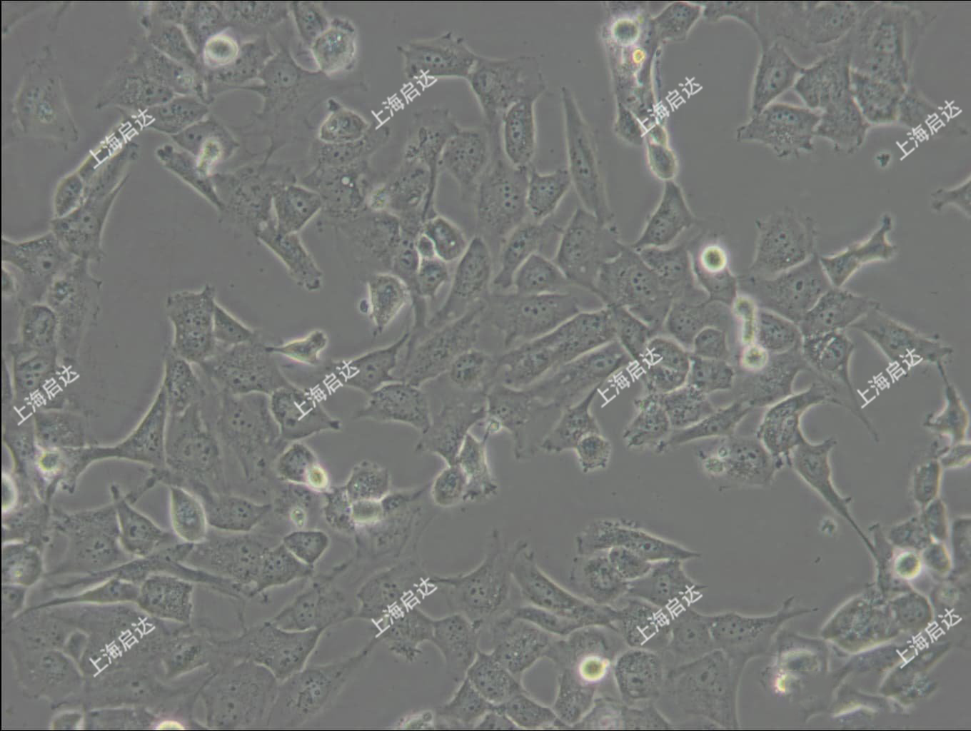 WPMY-1人正常前列腺基质永生化细胞