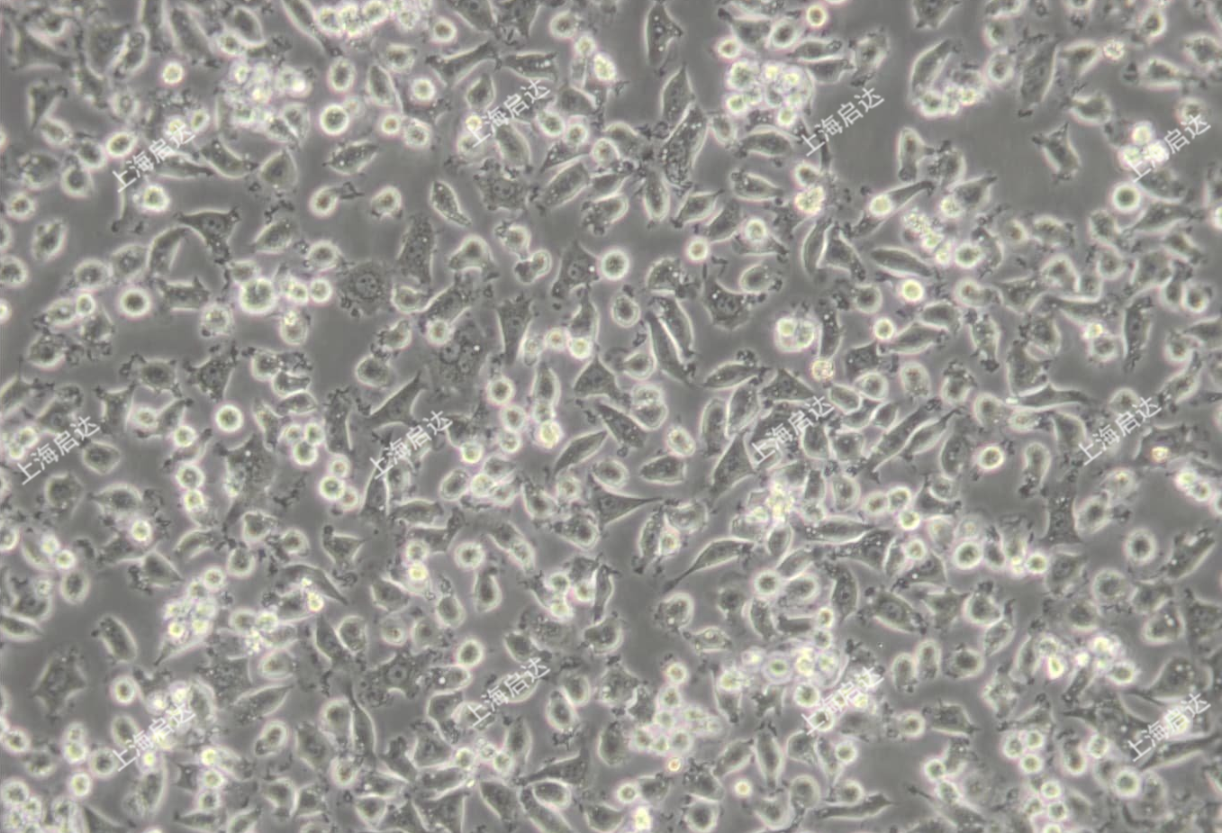 NCTC 1469 [NCTC1469]小鼠正常肝细胞