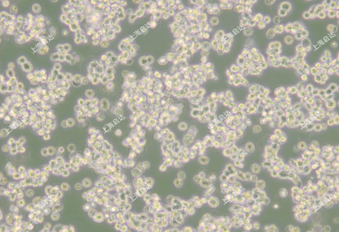 SK-NEP-1人肾母细胞瘤细胞(半悬浮)