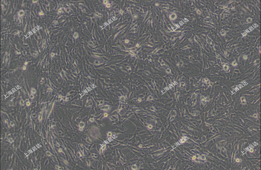 U251人神经胶质细胞瘤细胞