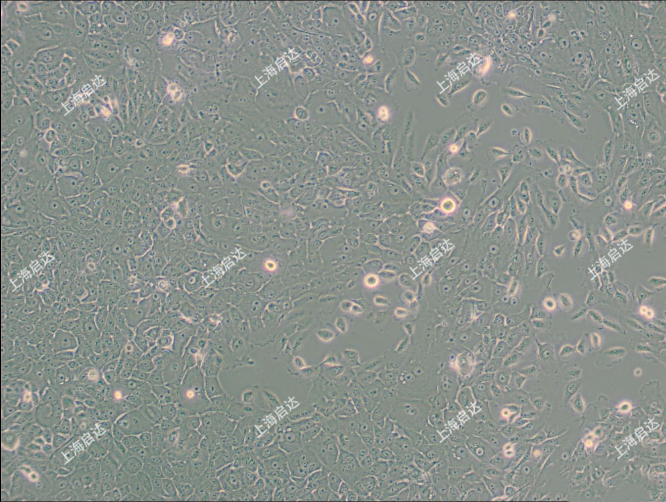 MCF-10A	[MCF 10A]人乳腺上皮细胞