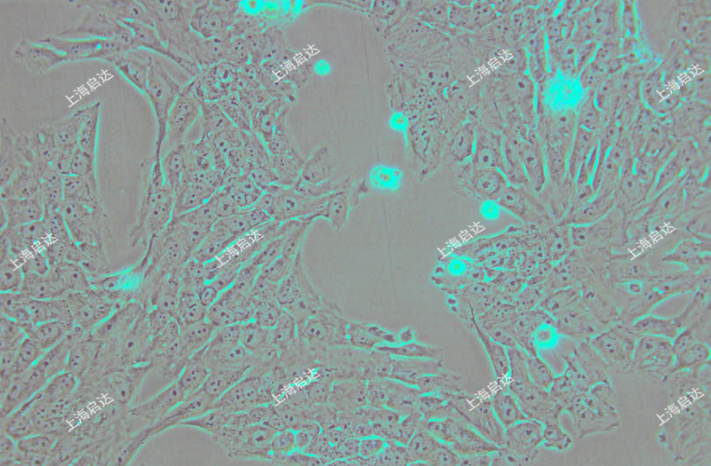 SK-N-AS人神经母细胞瘤细胞