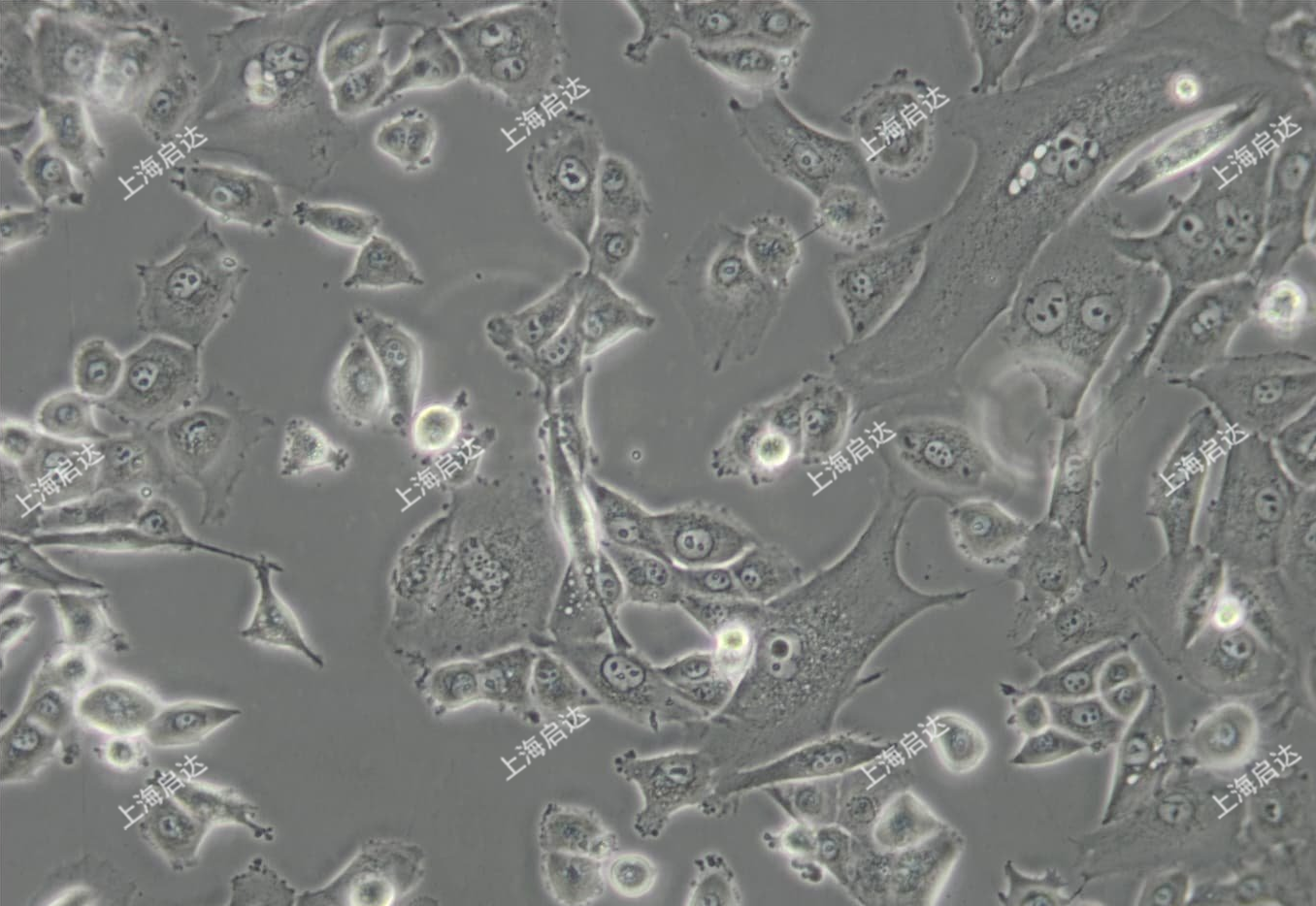 NCI-H226非小细胞肺腺鳞癌细胞