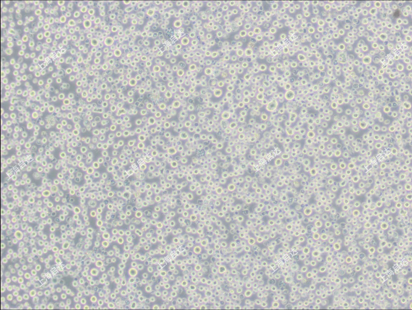 U266B1人骨髓瘤细胞