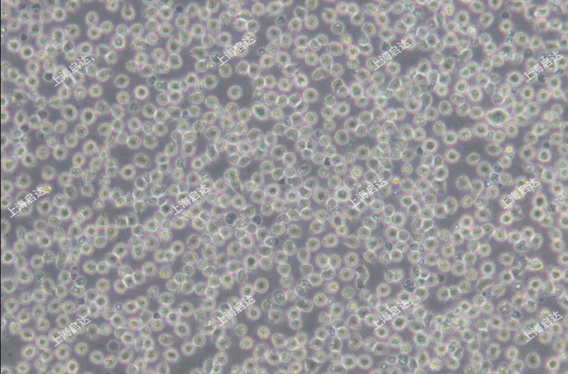 A3人T淋巴细胞白血病细胞