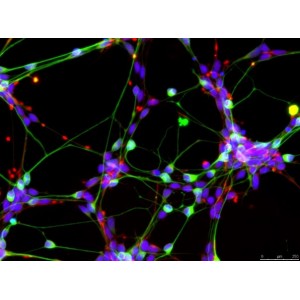 iPSC分化的运动神经元（正常人）