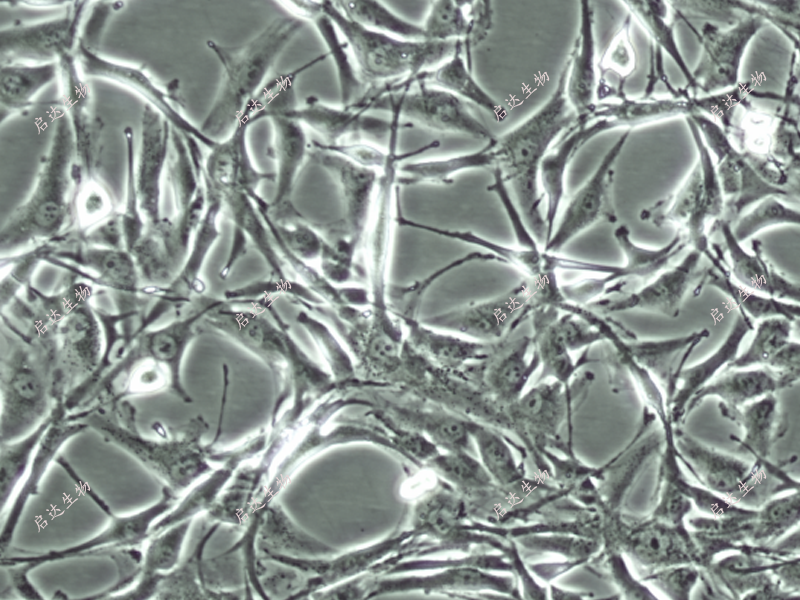 A-172 [A172]人胶质母细胞瘤细胞